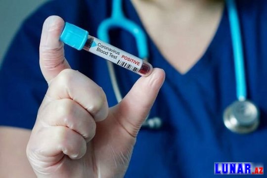 Azərbaycanda daha 43 yeni koronavirus AŞKARLANDI