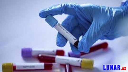 Koronavirusa qarşı immuniteti zəiflədən amil müəyyən edildi